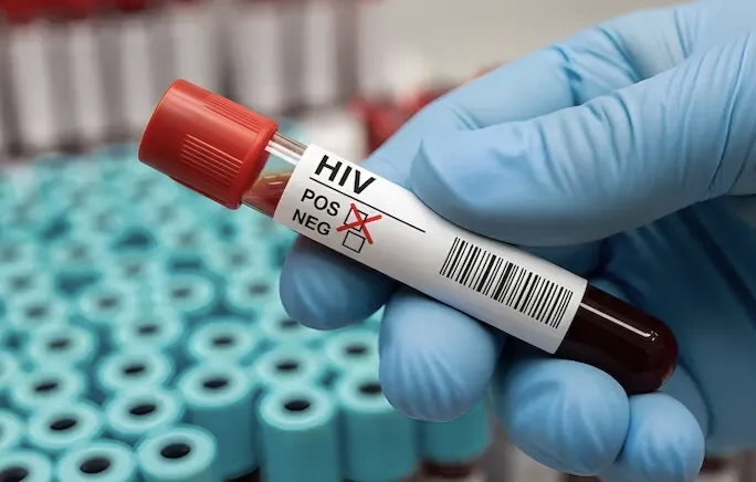 Kasus HIV di Bahodopi Melonjak, Dinkes Morowali Lakukan Pengendalian Intervensi Aktif